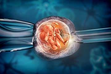 IVF